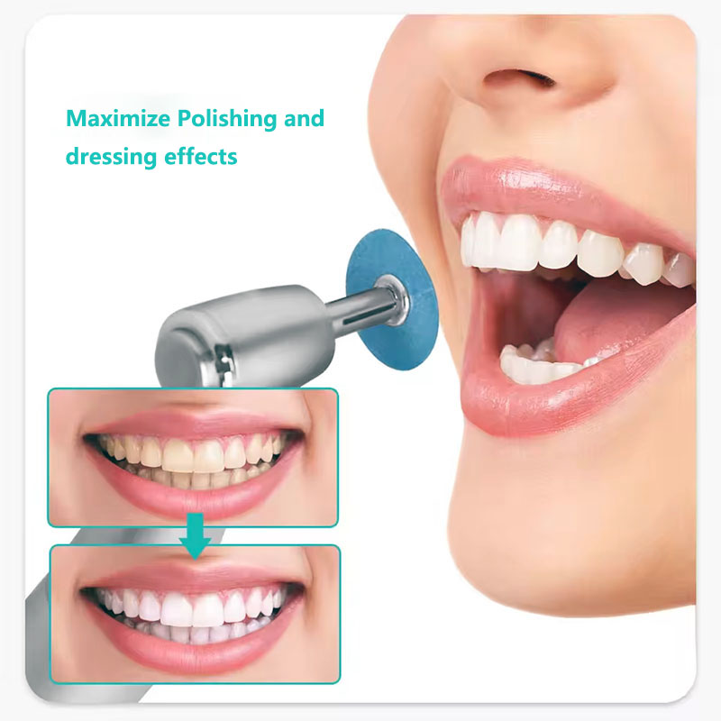 40pcs Dental Polishing Discs H - Teeth Whitening Uk ulasan dan harga