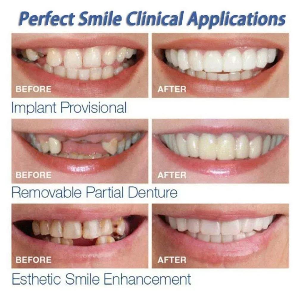 Best Sellers  Teeth Kit Fake T - Teeth Whitening Kit ulasan dan harga