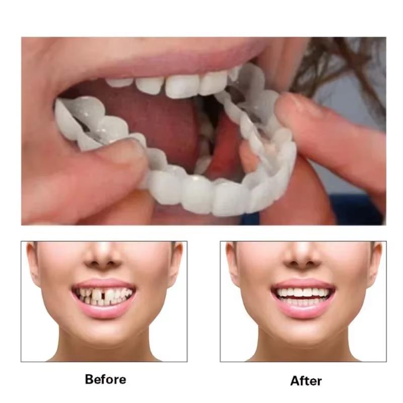 Best Sellers  Teeth Kit Fake T - Teeth Whitening Kit ulasan dan harga
