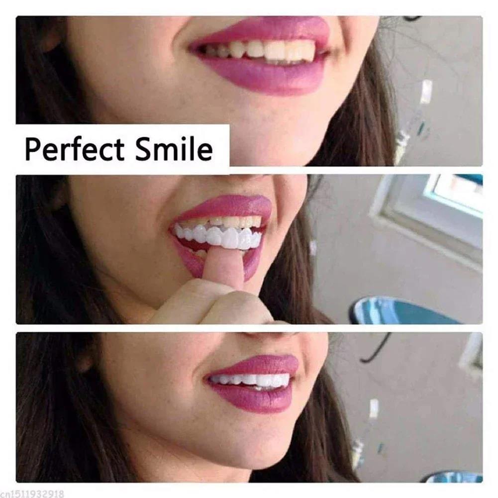 Best Sellers  Teeth Kit Fake T - Teeth Whitening Kit ulasan dan harga