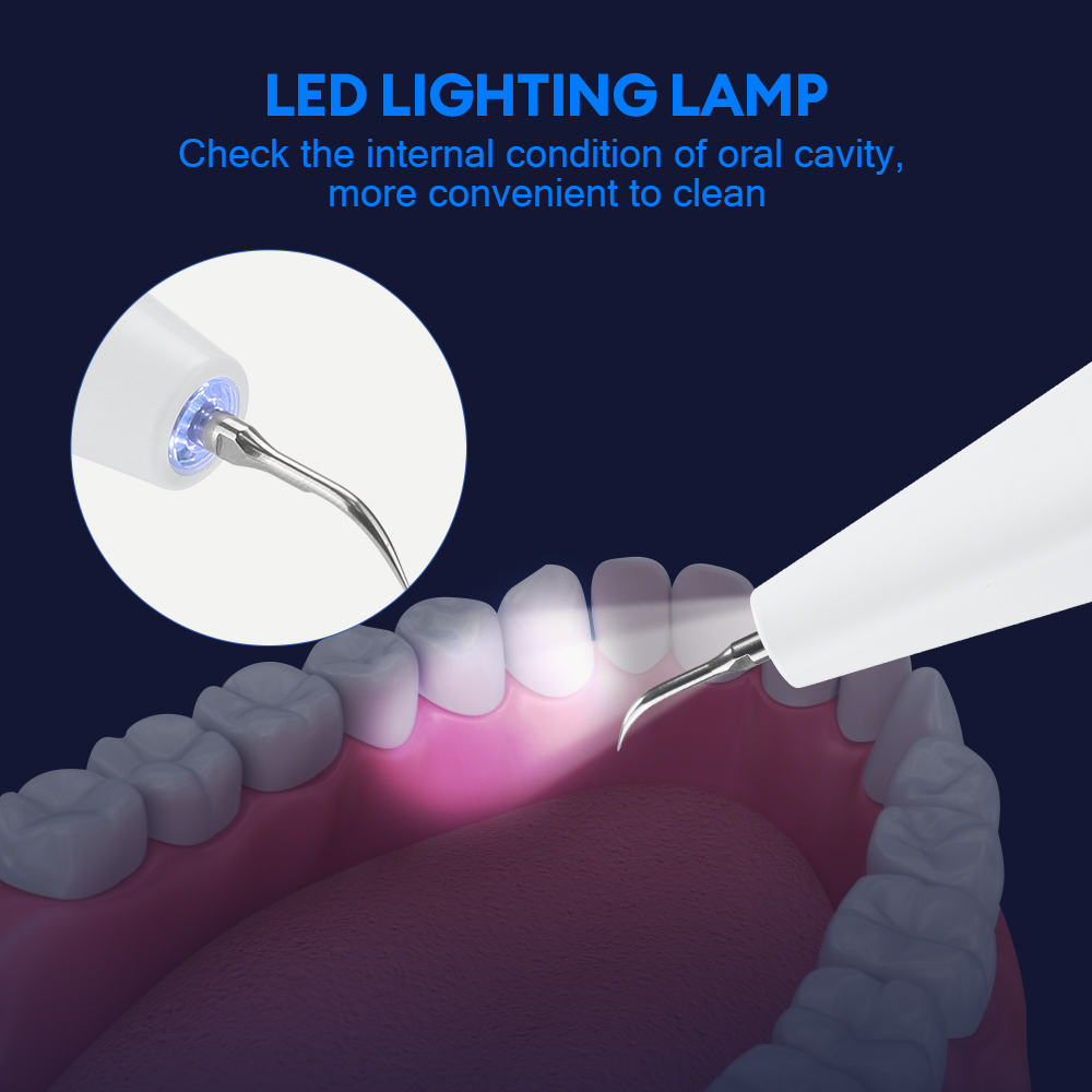Ultrasonic Dental Calculus Rem - Teeth Whitening Uk ulasan dan harga